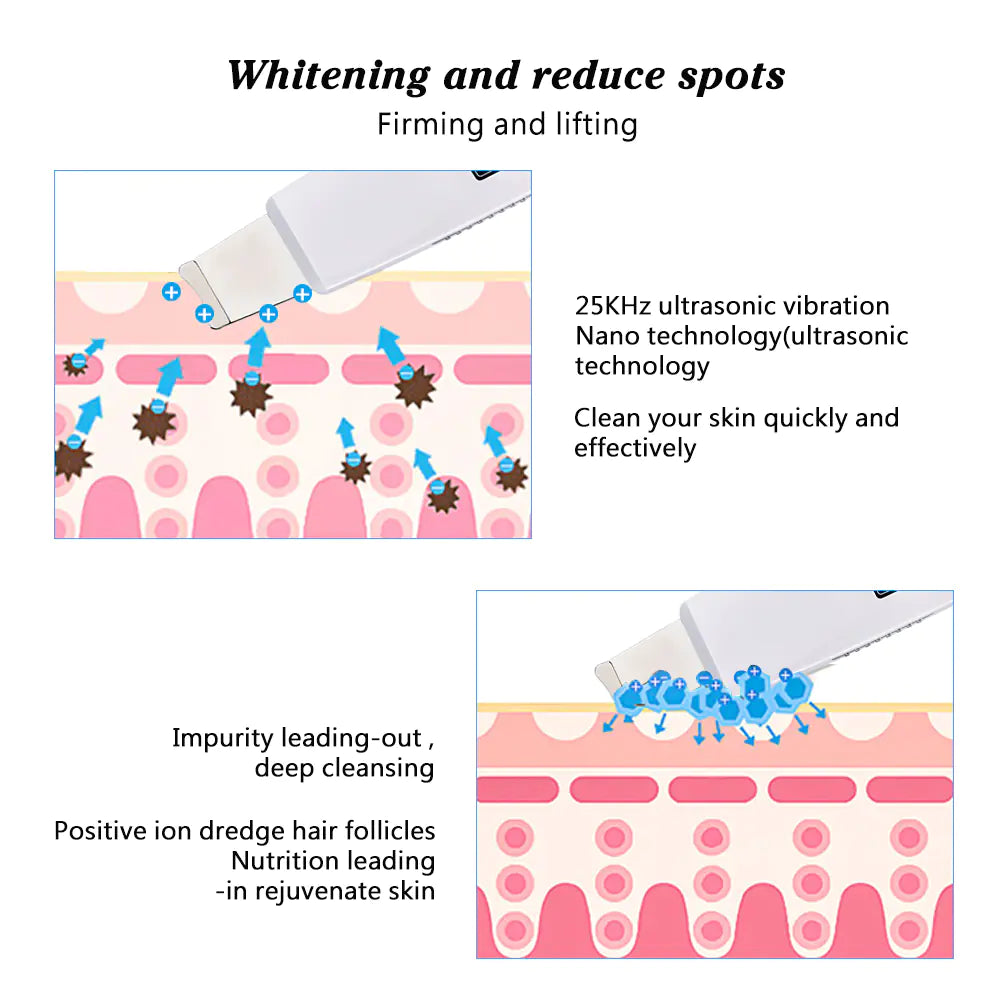 Ultrasonic Facial Cleanser with Pore Vacuum Device