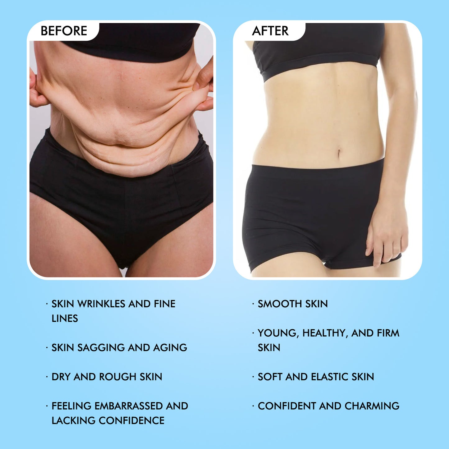 LIFT SKIN Firming Body Cream for Hydration