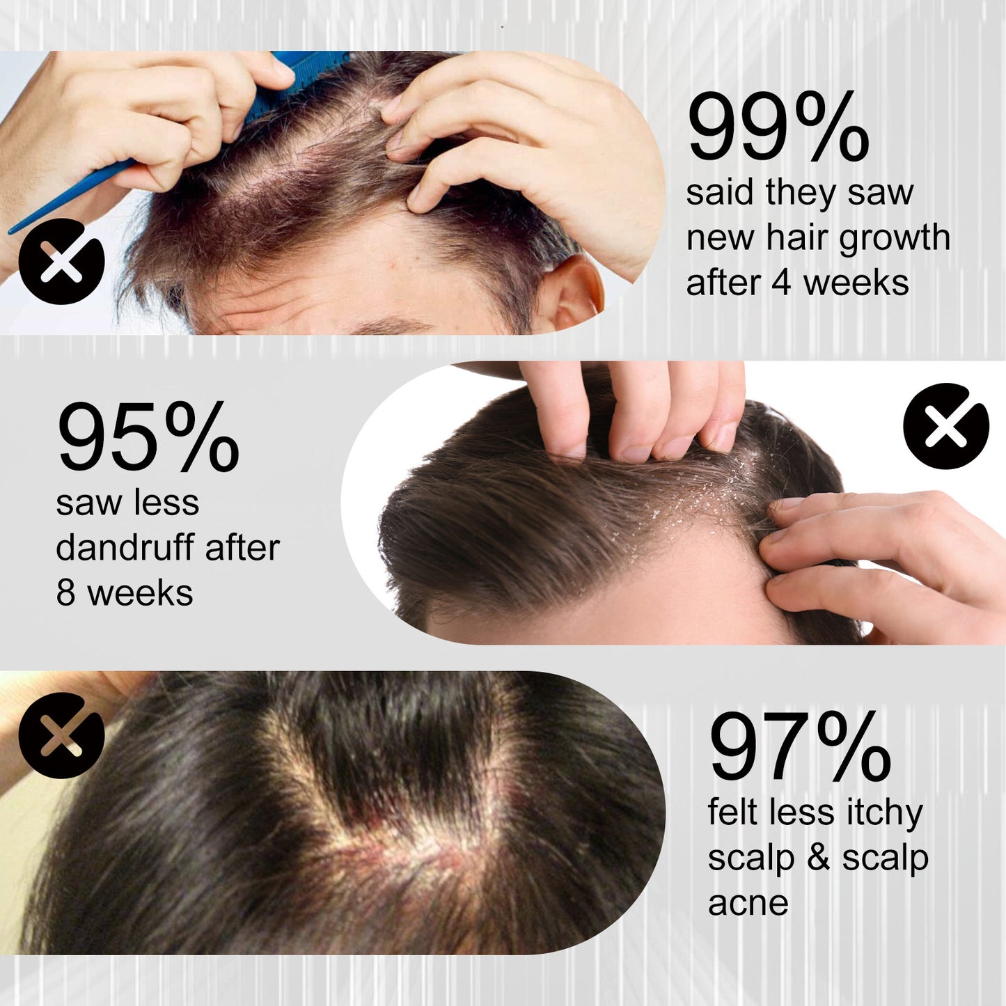 West & Month Hair Growth Spray for Nourishing Roots