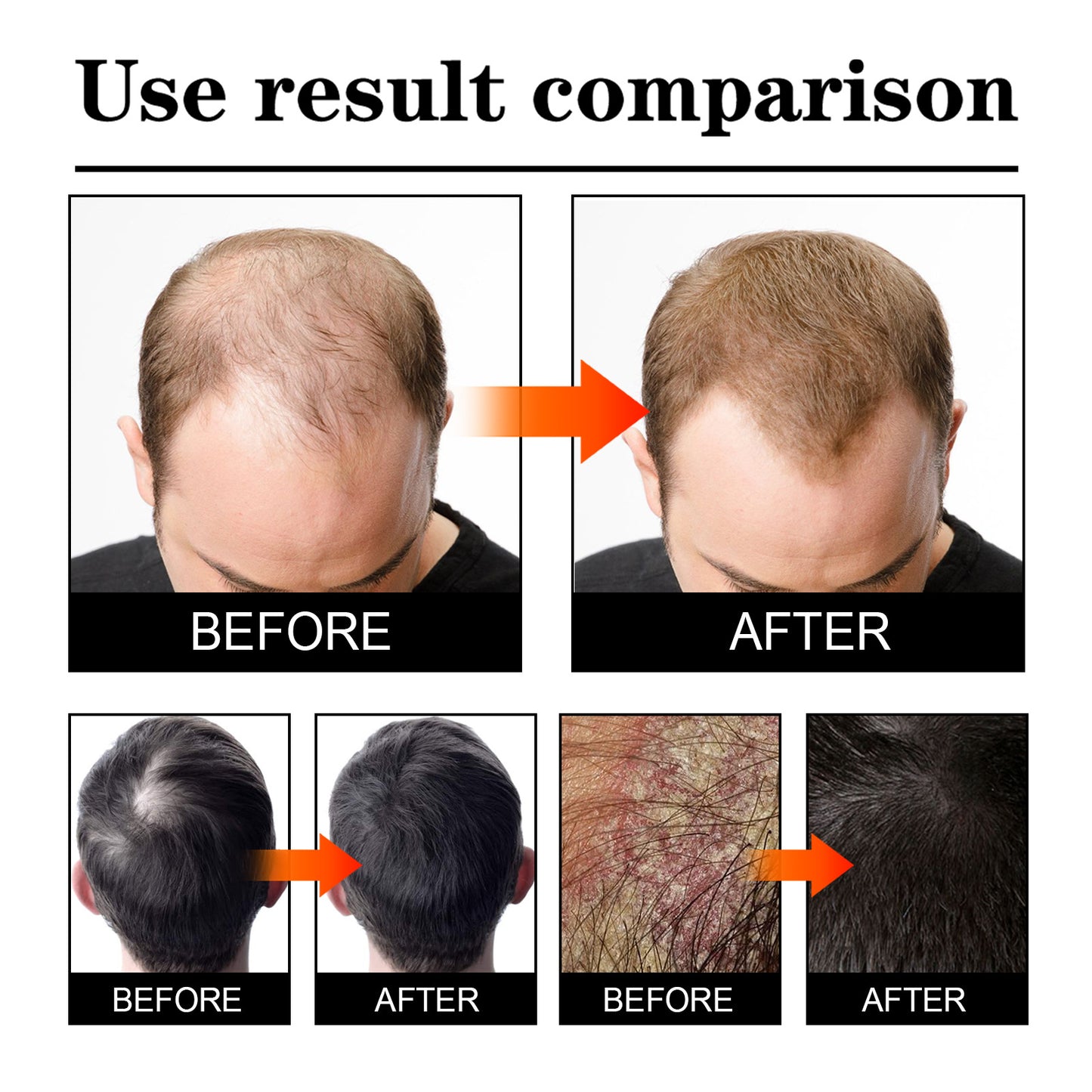 West & Month Hair Growth Spray for Nourishing Roots